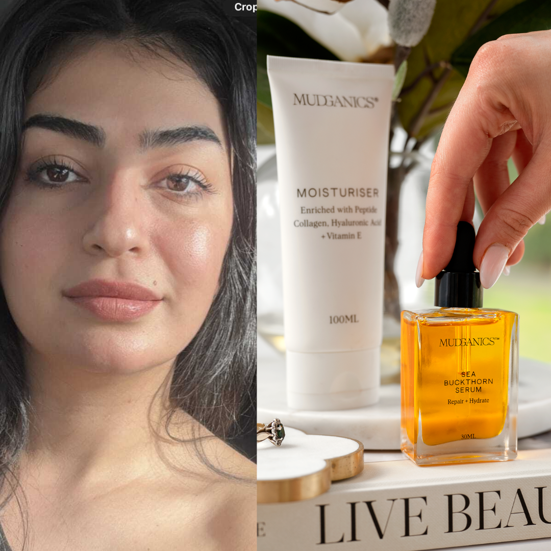 From Reactive to Radiant: How Rasha Restored Her Skin in Just Weeks