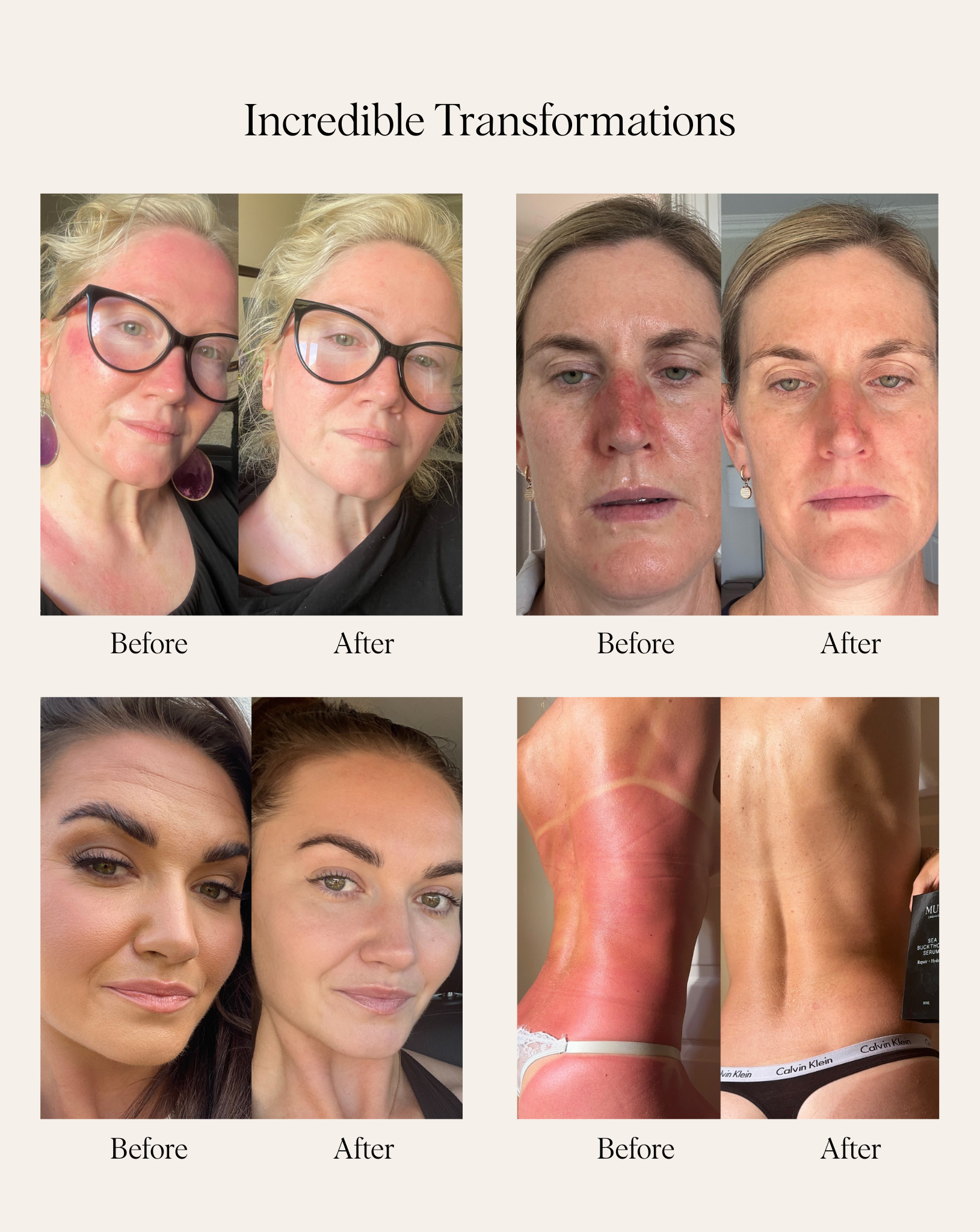 Sensitive Skin and Ageing: Finding Products That Won’t Fight Each Other